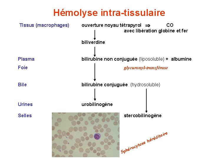 Hémolyse intra-tissulaire Tissus (macrophages) ouverture noyau tétrapyrol CO avec libération globine et fer biliverdine