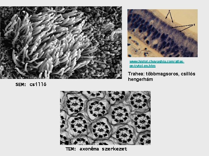 www. histol. chuvashia. com/atlasen/cytol-en. htm Trahea: többmagsoros, csillós hengerhám SEM: csilló TEM: axonéma szerkezet