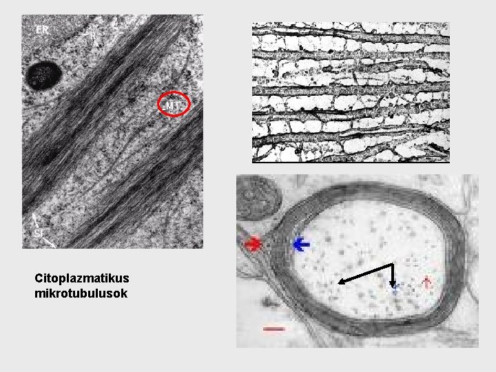 Citoplazmatikus mikrotubulusok 