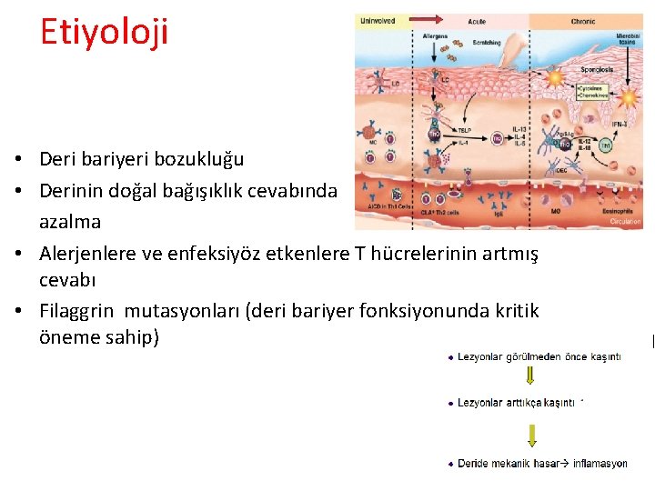 Etiyoloji • Deri bariyeri bozukluğu • Derinin doğal bağışıklık cevabında azalma • Alerjenlere ve