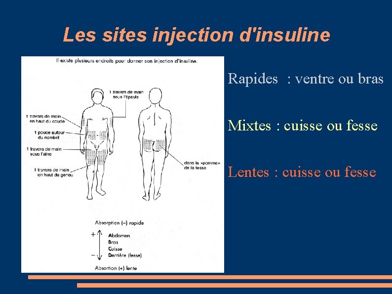 Les sites injection d'insuline Rapides : ventre ou bras Mixtes : cuisse ou fesse