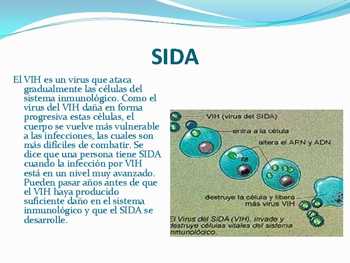 SIDA El VIH es un virus que ataca gradualmente las células del sistema inmunológico.