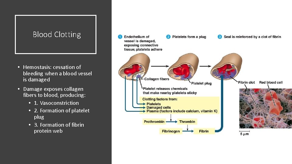 Blood Clotting • Hemostasis: cessation of bleeding when a blood vessel is damaged •