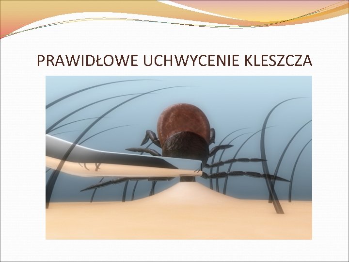 PRAWIDŁOWE UCHWYCENIE KLESZCZA 