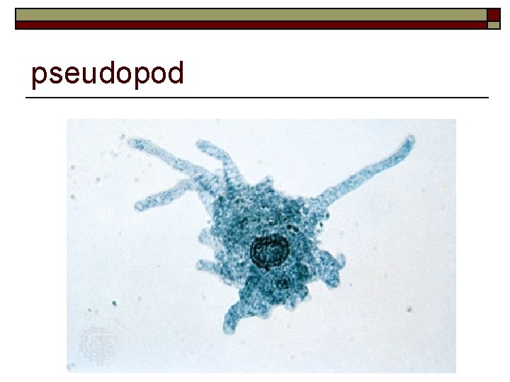 pseudopod 