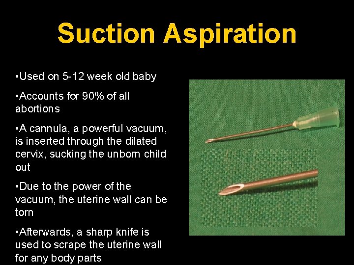 Suction Aspiration • Used on 5 -12 week old baby • Accounts for 90%