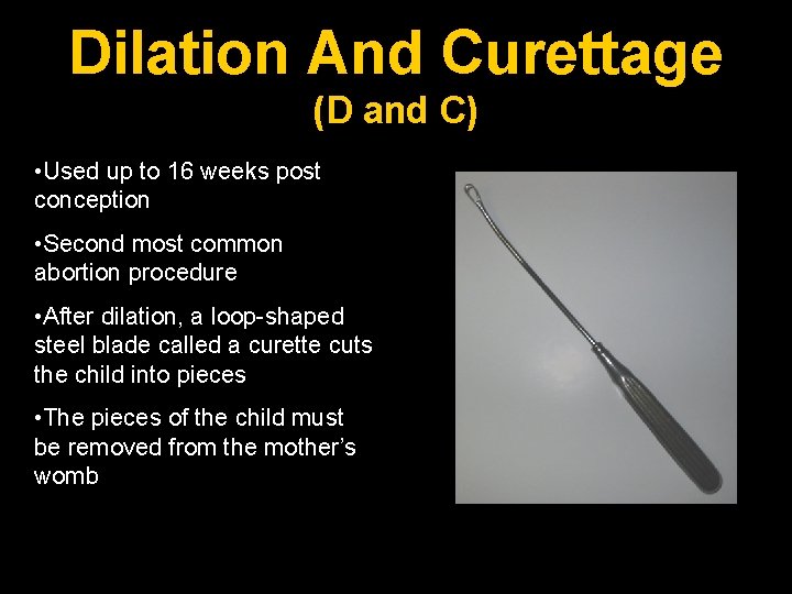 Dilation And Curettage (D and C) • Used up to 16 weeks post conception