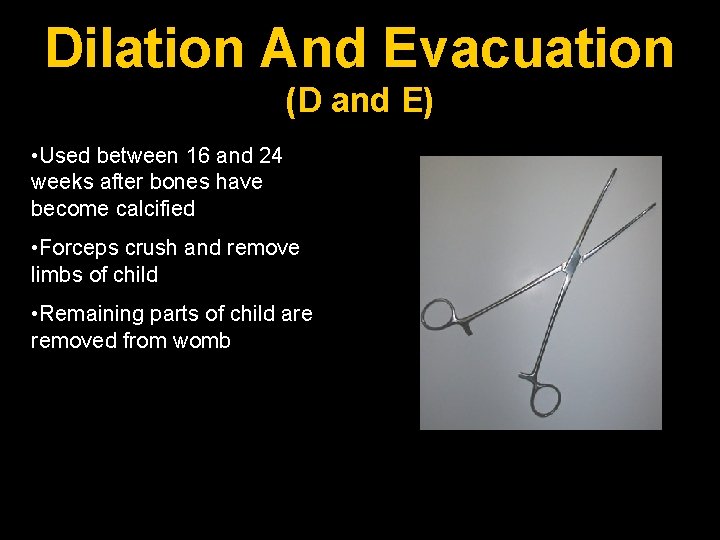 Dilation And Evacuation (D and E) • Used between 16 and 24 weeks after