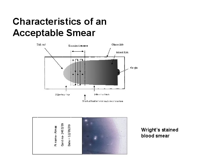 Date – 12/09/09 Card no- 2453/09 Pt name- Almaz Characteristics of an Acceptable Smear