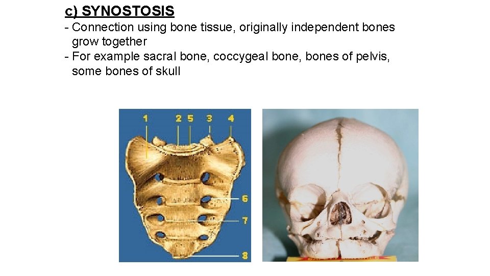 c) SYNOSTOSIS - Connection using bone tissue, originally independent bones grow together - For