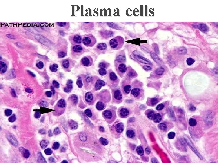 Plasma cells 