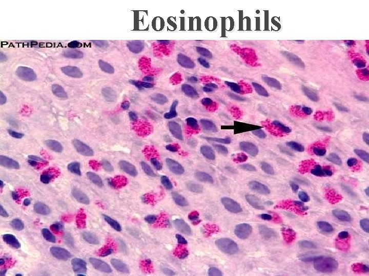 Eosinophils 