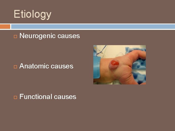 Etiology Neurogenic causes Anatomic causes Functional causes 