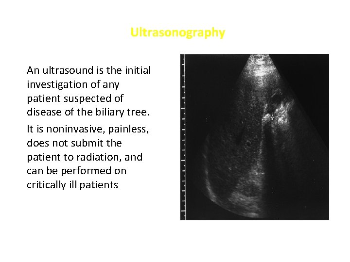 Ultrasonography An ultrasound is the initial investigation of any patient suspected of disease of