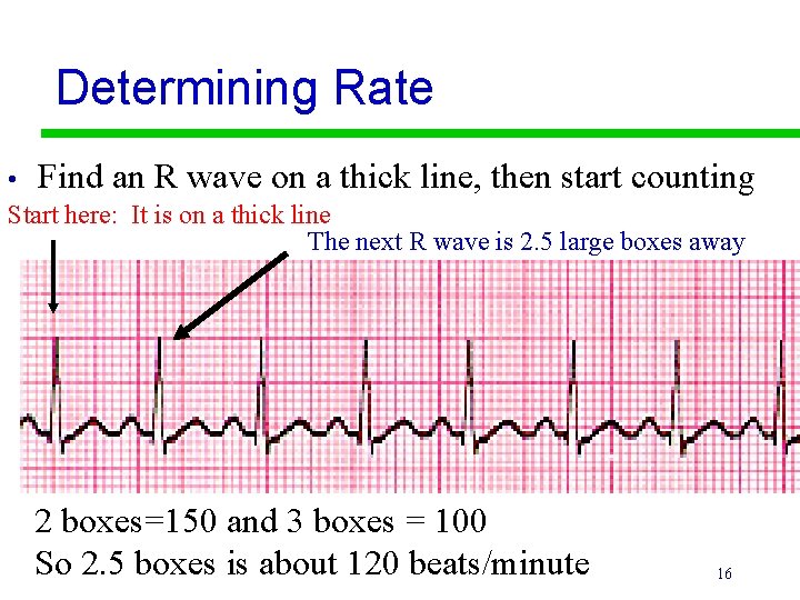Determining Rate • Find an R wave on a thick line, then start counting