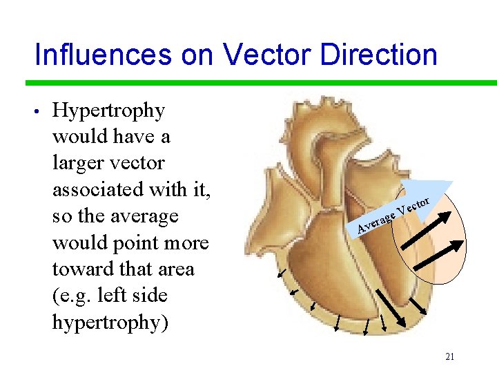 Influences on Vector Direction • Hypertrophy would have a larger vector associated with it,