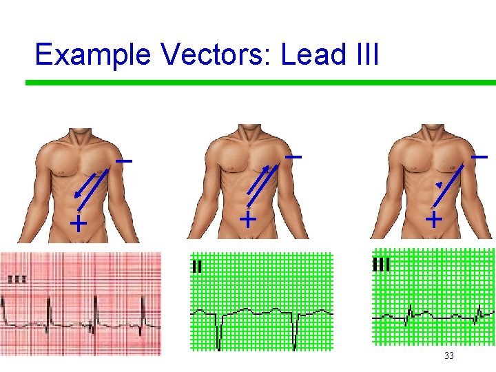 Example Vectors: Lead III 33 
