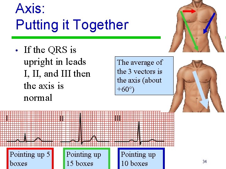 Axis: Putting it Together • If the QRS is upright in leads I, II,
