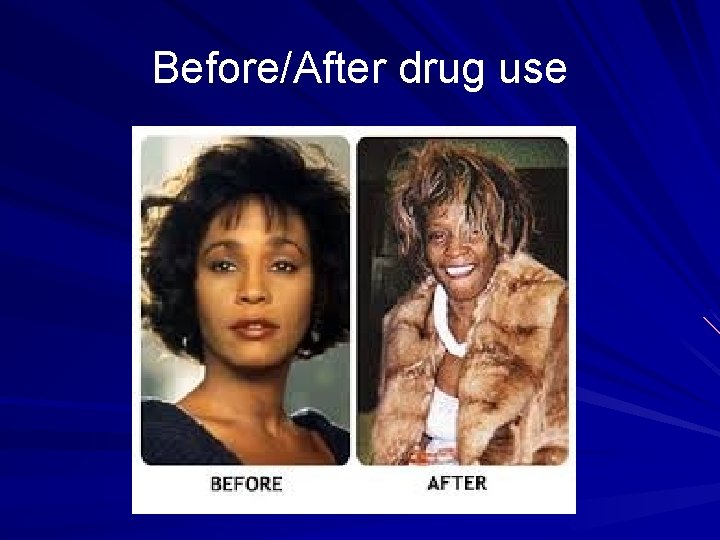 Before/After drug use 