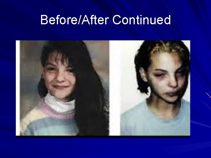 Before/After Continued 