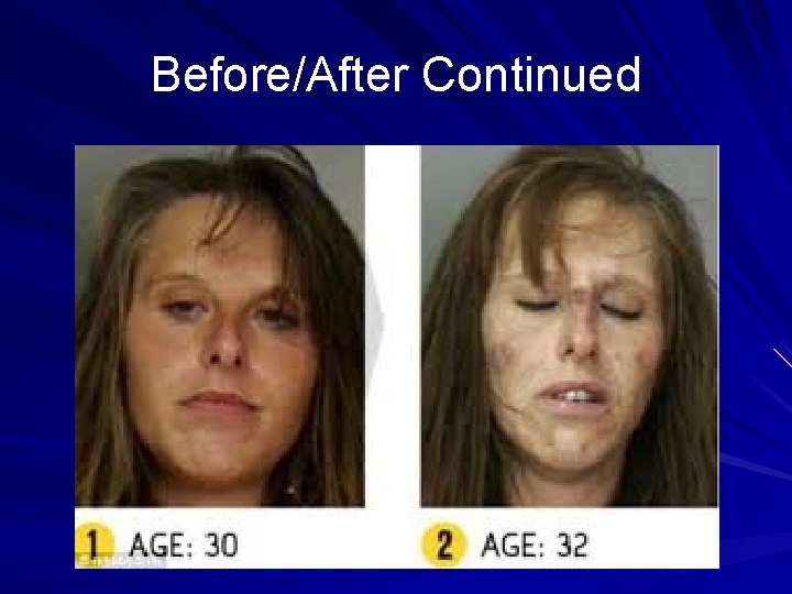 Before/After Continued 