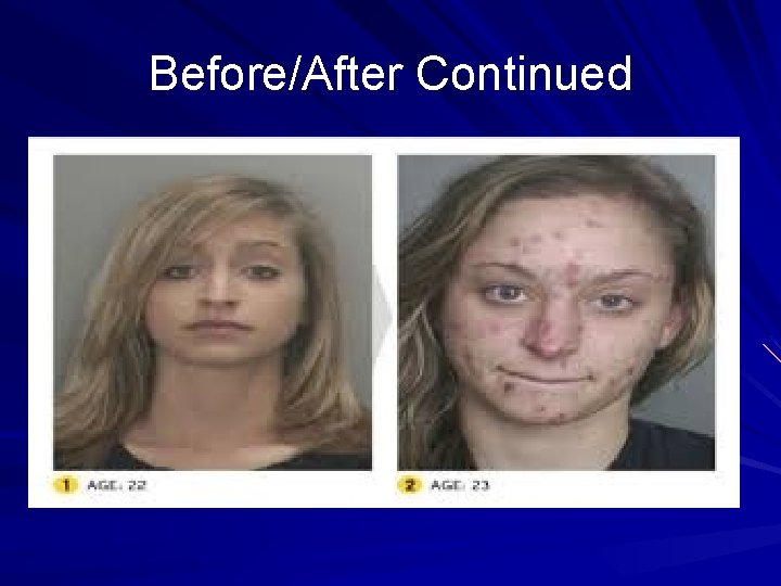 Before/After Continued 