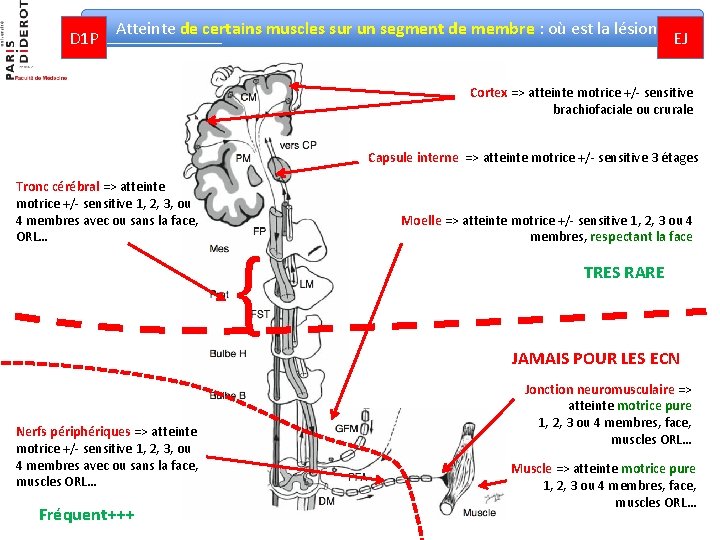 D 1 P Atteinte de certains muscles sur un segment de membre : où