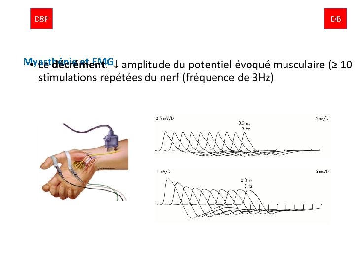 D 8 P Myasthénie et EMG • DB 