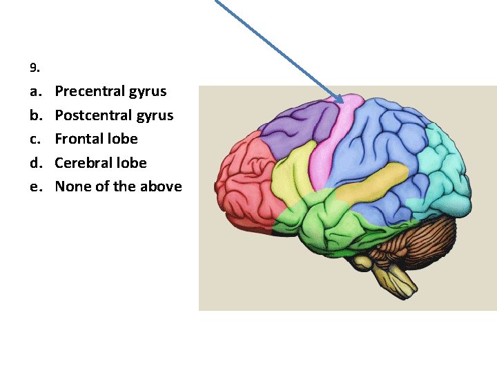 9. a. b. c. d. e. Precentral gyrus Postcentral gyrus Frontal lobe Cerebral lobe