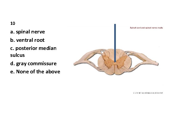 10 a. spinal nerve b. ventral root c. posterior median sulcus d. gray commissure