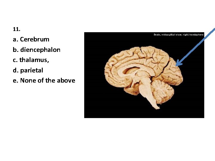 11. a. Cerebrum b. diencephalon c. thalamus, d. parietal e. None of the above