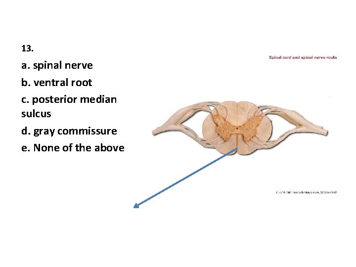 13. a. spinal nerve b. ventral root c. posterior median sulcus d. gray commissure