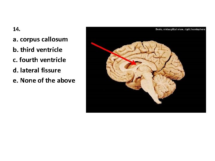 14. a. corpus callosum b. third ventricle c. fourth ventricle d. lateral fissure e.
