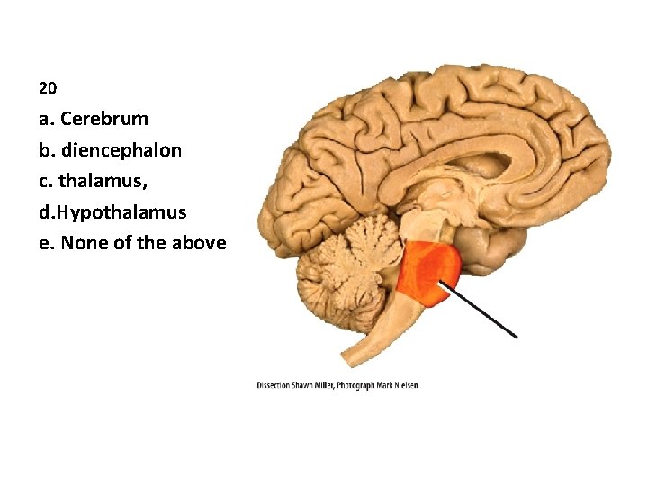 20 a. Cerebrum b. diencephalon c. thalamus, d. Hypothalamus e. None of the above