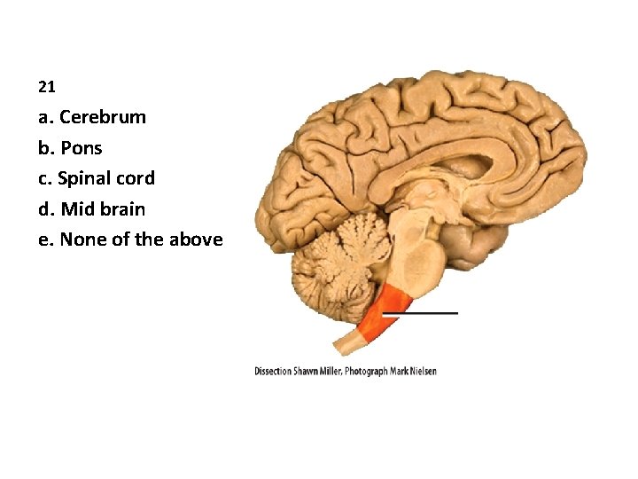 21 a. Cerebrum b. Pons c. Spinal cord d. Mid brain e. None of