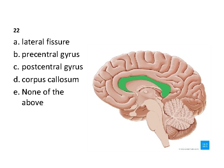 22 a. lateral fissure b. precentral gyrus c. postcentral gyrus d. corpus callosum e.