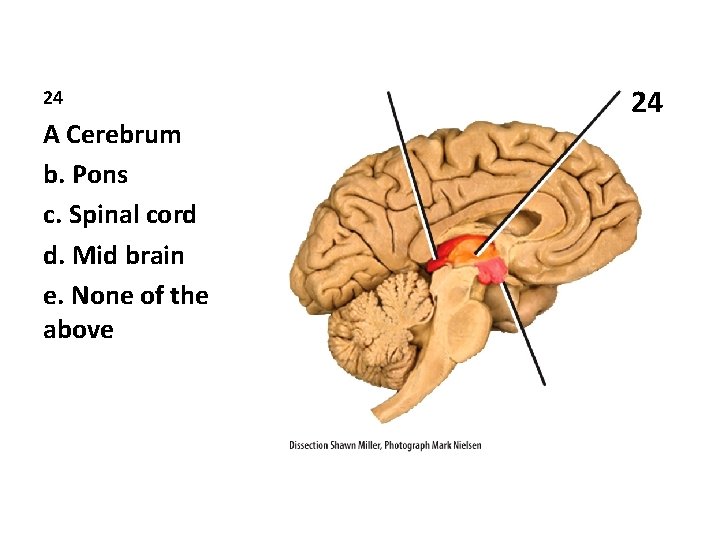 24 A Cerebrum b. Pons c. Spinal cord d. Mid brain e. None of