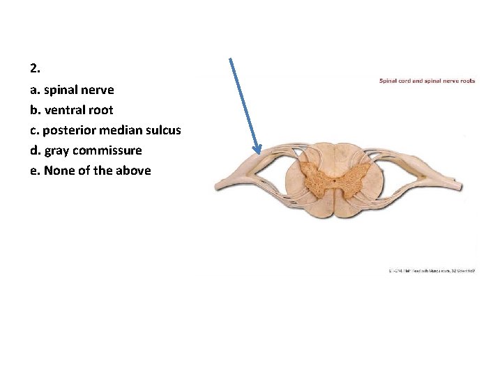 2. a. spinal nerve b. ventral root c. posterior median sulcus d. gray commissure