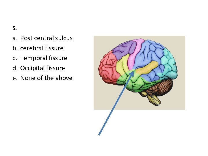 5. a. b. c. d. e. Post central sulcus cerebral fissure Temporal fissure Occipital