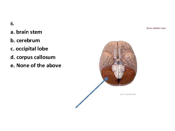 6. a. brain stem b. cerebrum c. occipital lobe d. corpus callosum e. None