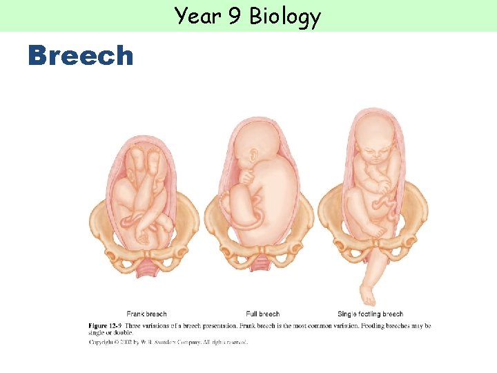 Year 9 Biology Breech  Year 9 Biology Breech