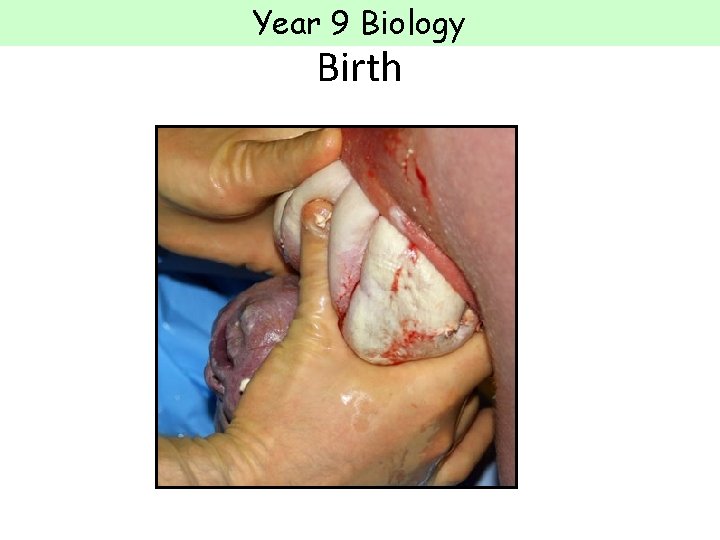 Year 9 Biology Birth  Year 9 Biology Birth