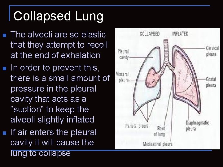 Collapsed Lung n n n The alveoli are so elastic that they attempt to