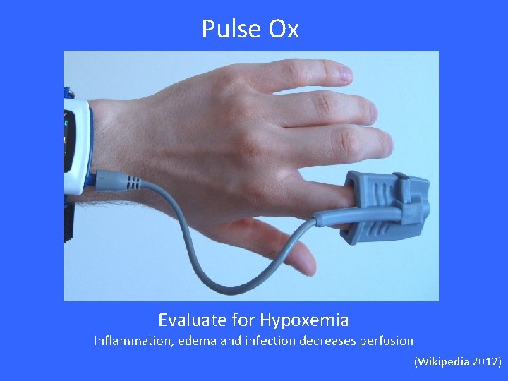 Pulse Ox Evaluate for Hypoxemia Inflammation, edema and infection decreases perfusion (Wikipedia 2012) 