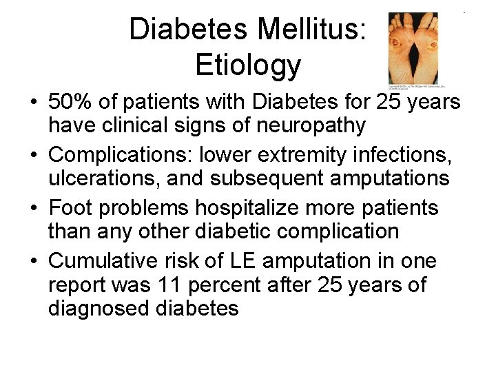 Diabetes Mellitus: Etiology • 50% of patients with Diabetes for 25 years have clinical