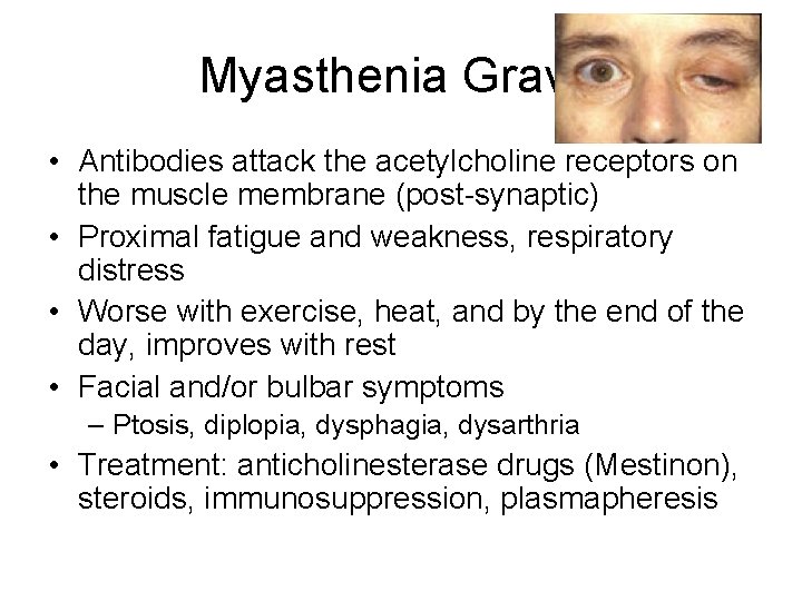 Myasthenia Gravis • Antibodies attack the acetylcholine receptors on the muscle membrane (post-synaptic) •