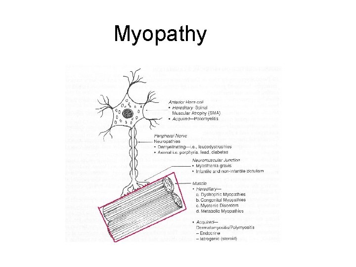 Myopathy 