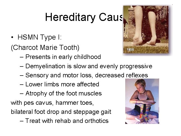 Hereditary Causes • HSMN Type I: (Charcot Marie Tooth) – Presents in early childhood