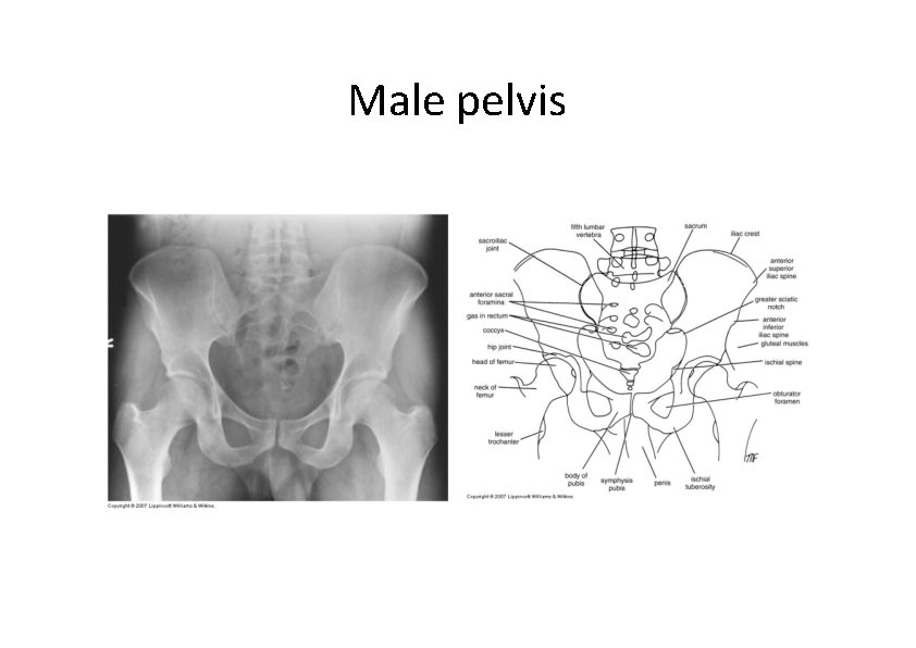 Male pelvis  Male pelvis