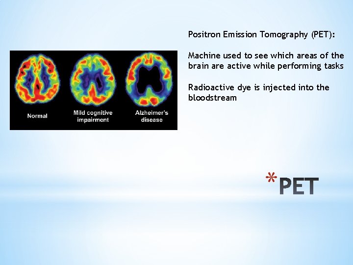 Positron Emission Tomography (PET): Machine used to see which areas of the brain are